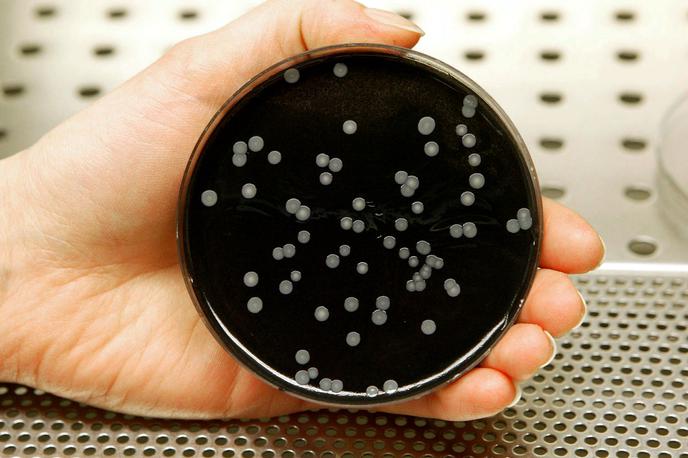 legionarska bolezen legionela kolonije voda | Legionelozo povzroča bakterija legionela.  | Foto Reuters
