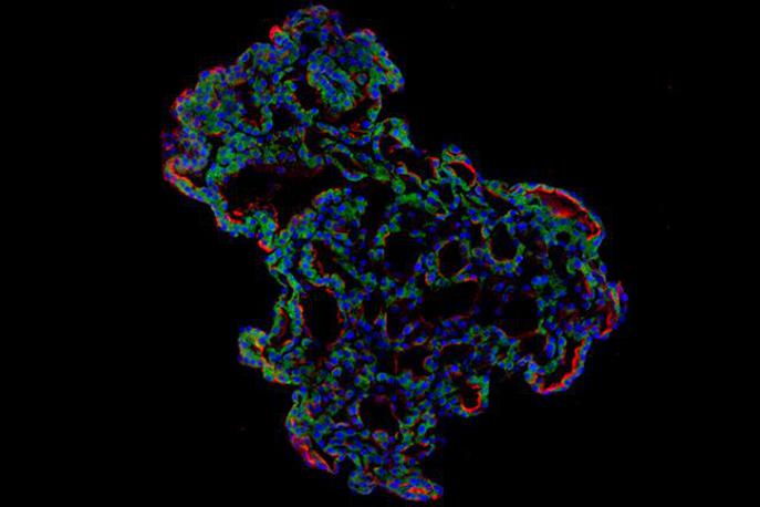 Pljuča Covid | Očem prijazna uprizoritev sicer mikroskopskega tridimenzionalnega organskega modela človeških pljuč, ki so jih v petrijevki vzgojili znanstveniki. | Foto Jeonghwan Youk, Taewoo Kim, Seon Pyo Hong