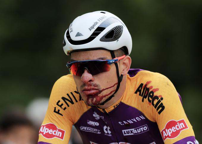 Lani je v prvi etapi Toura grdo padel in si pridelal kopico šivov pod ustnico.  | Foto: Reuters
