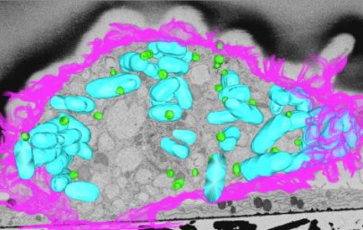 maščobe, bakterije | Makrofag, v katerem invazivno bakterijo (modro) napadajo "oborožene" kapljice maščobe (tirkizno). | Foto University of Queensland