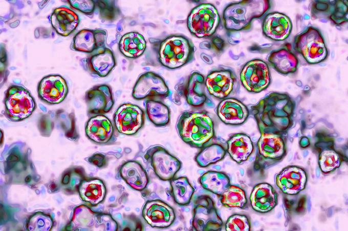 Virus iz družine Morbillivirus, ki povzroča ošpice, pod mikroskopom. | Foto: Guliverimage