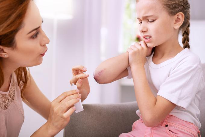 Ob otrokovi poškodbi bodite mirni, pokažite mu, da imate situacijo pod kontrolo. Če je treba, brez odlašanja obiščite zdravnika.  | Foto: Getty Images