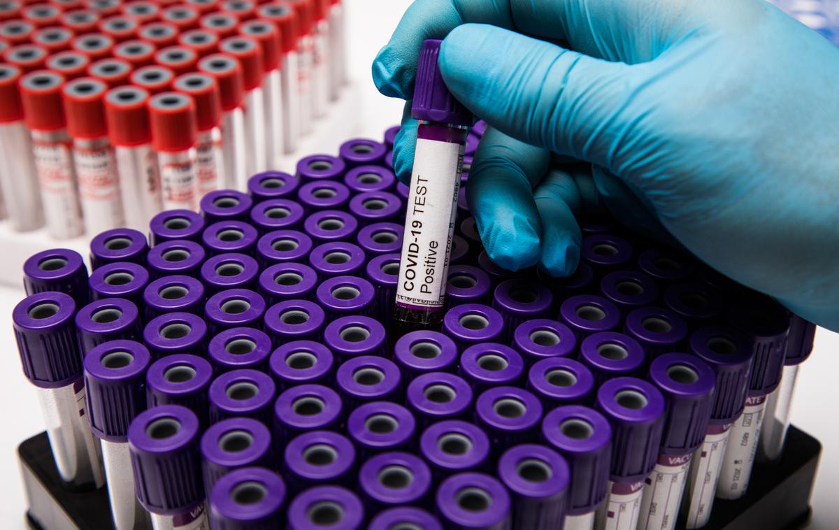 Covid. Koronavirus. Testiranje. Korona. Covid-19 | Aktivno okuženih je manj kot dan prej.  | Foto Shutterstock