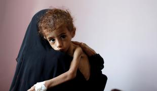 V Jemnu že polovica prebivalstva potrebuje pomoč v hrani
