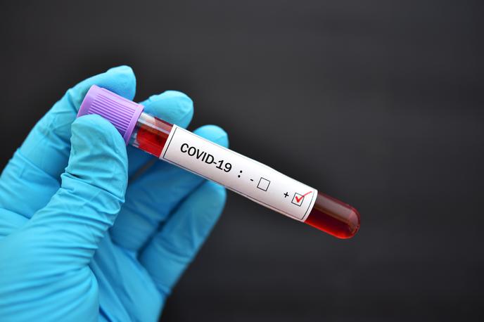 Koronavirus | V Sloveniji so zabeležili 34 okuženih ljudi, testirali so jih 1.643. | Foto Getty Images