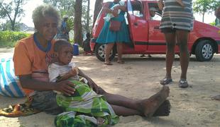Na Madagaskarju skoraj tisoč mrtvih v epidemiji ošpic