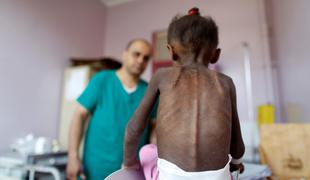 V krvavih spopadih najmanj 150 mrtvih, milijoni trpijo zaradi lakote