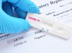 Koronavirus. Cepljenje. Test. Testiranje covid-19. Covid-19