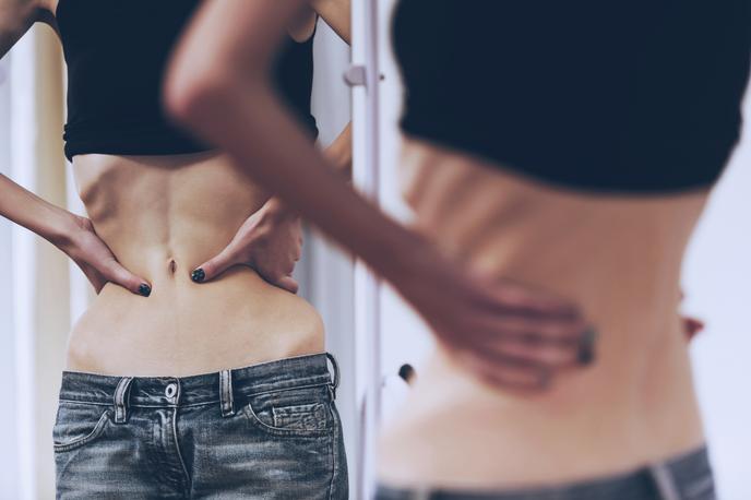 Anoreksija | Anoreksija je motnja hranjenja, za katero lahko zbolijo ljudje vseh starosti in obeh spolov, čeprav so k njej malo bolj nagnjena mlada dekleta in ženske. | Foto Getty Images