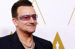 Nesrečni Bono si je poškodoval tudi obraz
