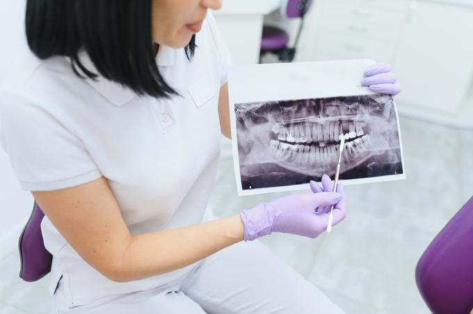 ortodont zobozdravnik | Foto: Shutterstock