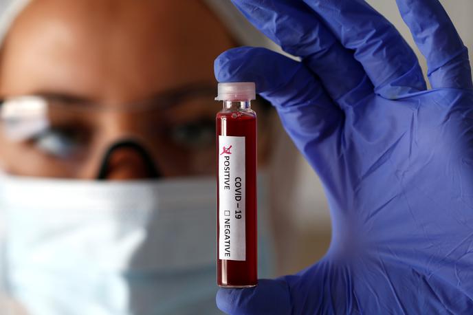 Koronavirus | Testiranje v Sloveniji se bo predvidoma začelo naslednji teden, rezultati pa naj bi bili znani še pred prvomajskimi prazniki. | Foto Reuters