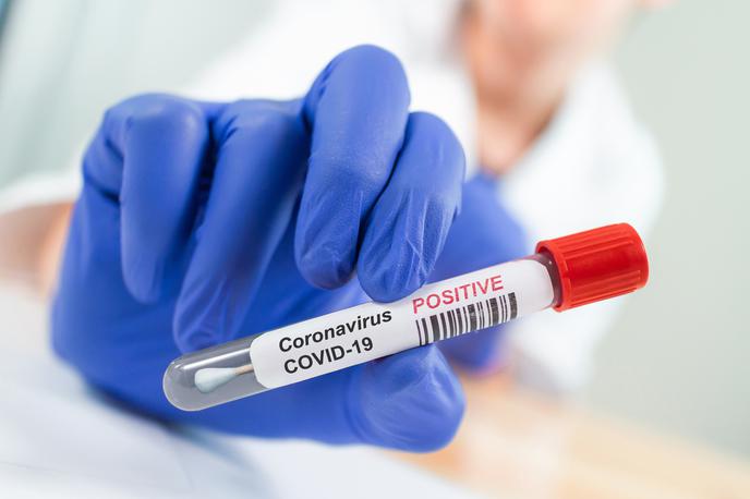 Koronavirus. | Foto Getty Images