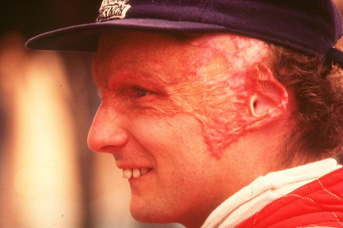 Niki Lauda 1976 | Foto Guliver/Getty Images