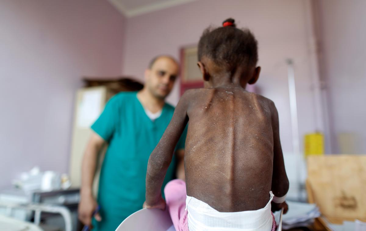 Jemen | Zaradi vojne v Jemnu je humanitarna kriza prizadela 14 milijonov ljudi. | Foto Reuters