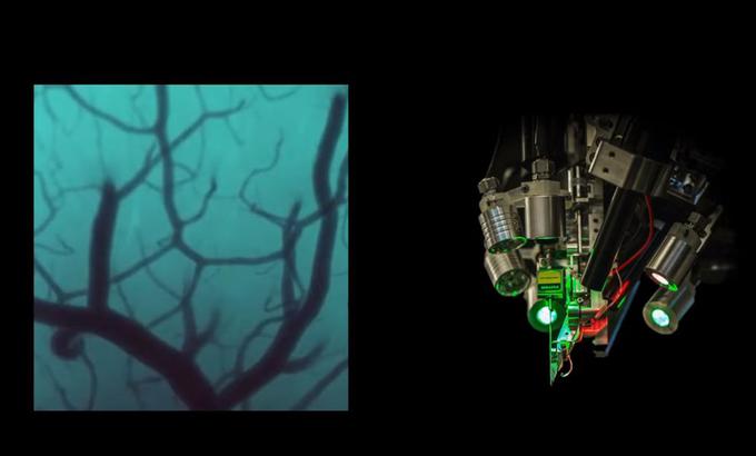 Robotski kirurg za vsajanje vlaken (desno) je videti strašljivo, a pri Neuralinku upajo, da bo vsaditev umetnih vlaken v človeške možgane z robotom sčasoma postala tako rutinski postopek kot danes laserska odprava dioptrije. | Foto: Neuralink / Posnetek zaslona