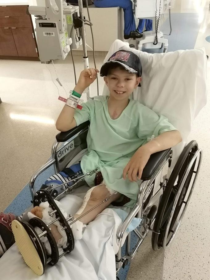 11-letni Marko Aberšek iz Maribora je zaradi napake na srcu in deformacije nog prestal že več kot 20 operacij. Trenutno je na Floridi, kjer okreva po posegu, ki naj bi mu pomagal do točke, ko se bo lahko enkrat za vselej znebil opornic, ki ga ovirajo pri gibanju. | Foto: osebni arhiv/Lana Kokl