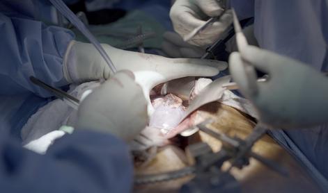 Umrl moški s prvo presajeno gensko spremenjeno ledvico prašiča