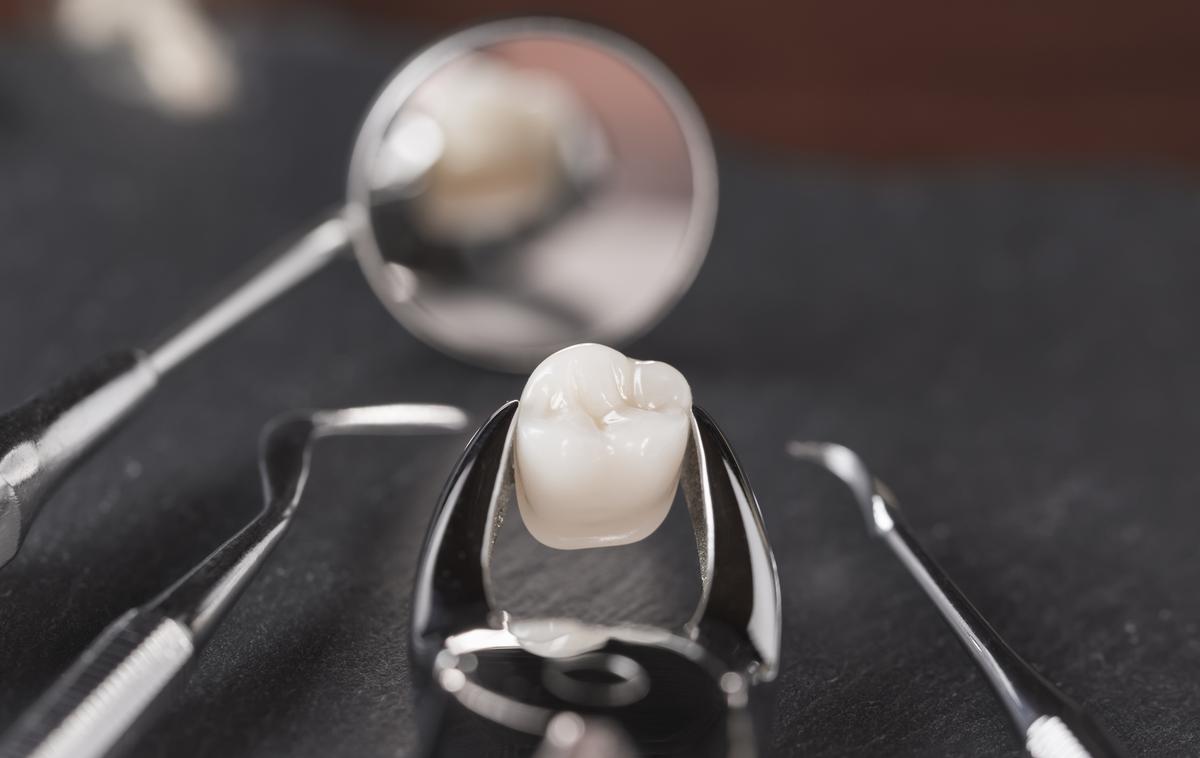 zobje zalivka zobar zdravje | V Evropskem parlamentu poudarjajo, da v EU kljub drugim možnostim še vedno vsako leto za zobne zalivke porabijo okoli 40 ton živega srebra. | Foto Thinkstock