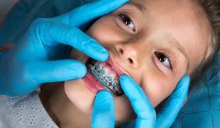 Otroci, ki so lani ostali brez ortodonta, zdravljenje nadaljujejo na stomatološki kliniki