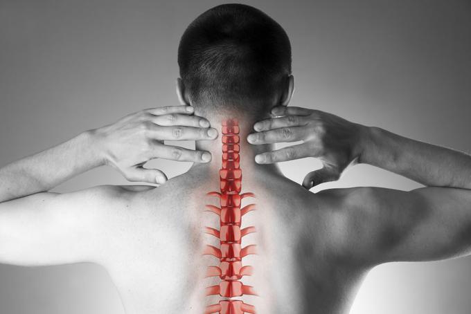 spondiloza-bolečine-vrat | Foto: Medicofit