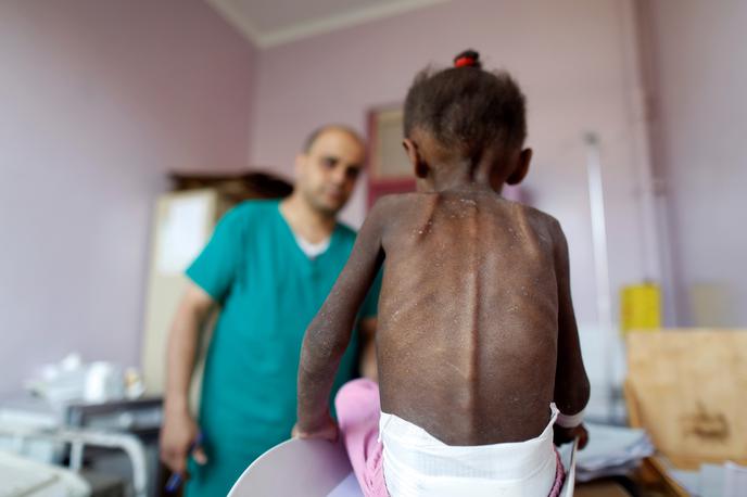 Jemen | Zaradi vojne v Jemnu je humanitarna kriza prizadela 14 milijonov ljudi. | Foto Reuters