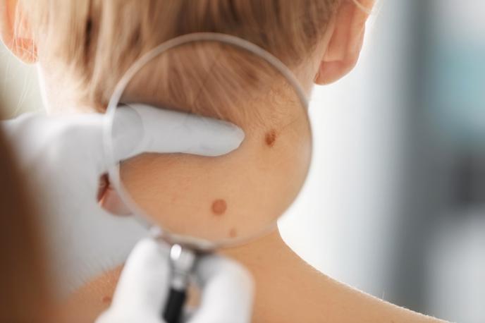 dermatolog | Foto Shutterstock
