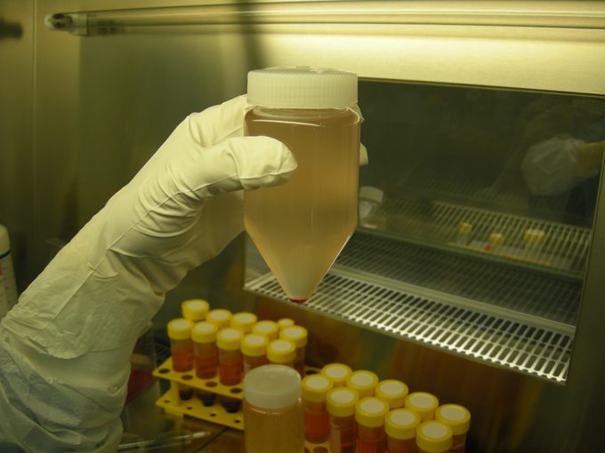 Matične celice zdravih darovalcev je treba najprej pridobiti, potem pa jih s posebnimi postopki razmnožiti v biotehnološkem laboratoriju. | Foto: 