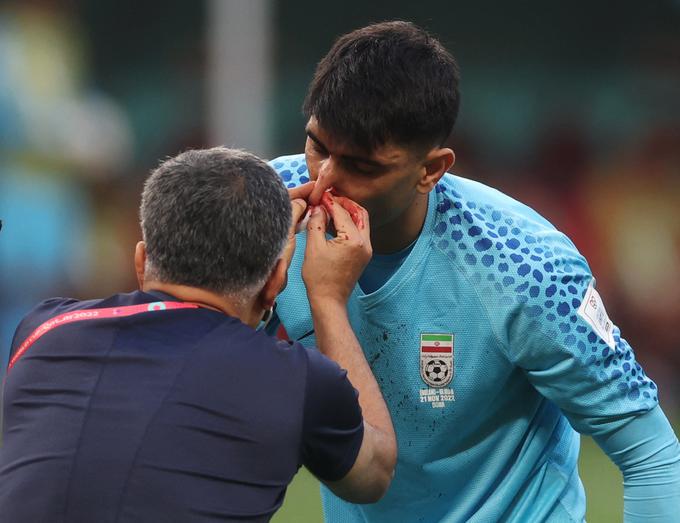 Na dvoboju med Iranom in Anglijo jo je skupil iranski vratar Alireza Beiranvand. Zaradi njegove poškodbe se je prvi polčas podaljšal za 14 minut. | Foto: Reuters