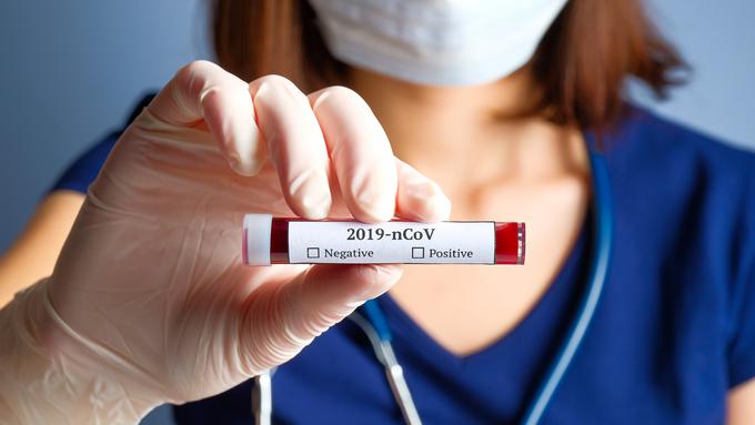 V BiH so v zadnjem dnevu potrdili rekordnih 363 novih okužb z novim koronavirusom, za boleznijo covid-19 pa je umrlo osem ljudi.  | Foto: Getty Images