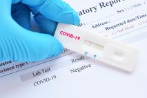 Koronavirus. Cepljenje. Test. Testiranje covid-19. Covid-19