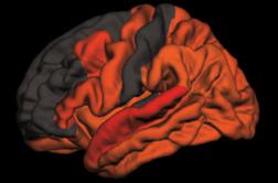Odkrili povezavo med pomanjkanjem kakovostnega spanca in Alzheimerjevo boleznijo