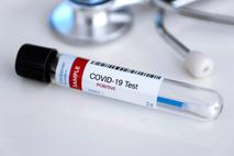 Covid. Koronavirus. Testiranje. Korona. Covid-19