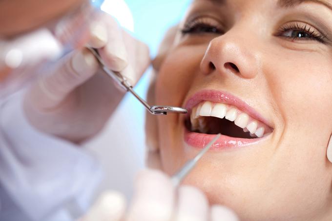 Zobozdravniki svarijo tudi pred preveč agresivnimi sredstvi za beljenje zob, ki vsebujejo prevelike količine vodikovega peroksida.  | Foto: Thinkstock