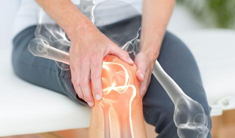 Boleče koleno: kako prepoznati artrozo kolena?