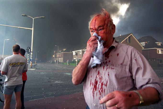 Nizozemci dogodku v Enschedeju pravijo "Vuurwerkramp", kar je nizozemsko za "pirotehnična katastrofa". Na fotografiji eden od približno tisoč prebivalcev Enschedeja, ki so se zaradi eksplozije poškodovali. | Foto: Reuters