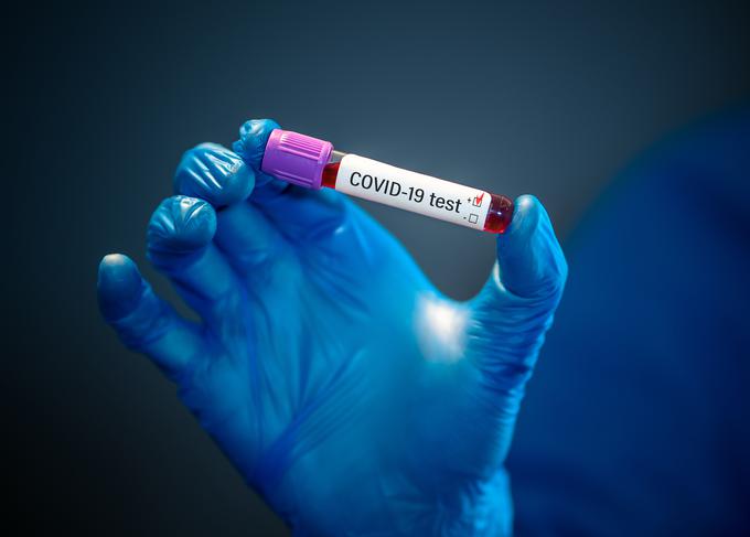 Zaradi epidemije koronavirusa je država v krču, meni Počivalšek. | Foto: Getty Images