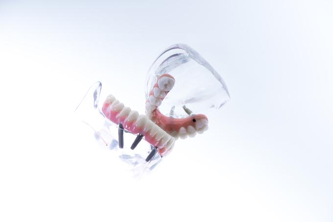 SMT Dent, zobni vsadki | Foto: ORTOIMPLANT DENTAL SPA