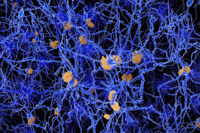nevroni, Alzheimerjeva bolezen | Nova odkritja o mehanizmu, ki povzroča apatijo, odpirajo obete za morebitne nove pristope pri zdravljenju Alzheimerjeve bolezni. | Foto RMIT