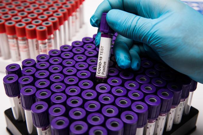Covid. Koronavirus. Testiranje. Korona. Covid-19 | Aktivno okuženih je manj kot dan prej.  | Foto Shutterstock