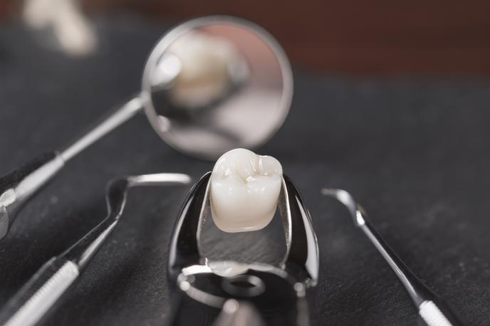 zobje zalivka zobar zdravje | V Evropskem parlamentu poudarjajo, da v EU kljub drugim možnostim še vedno vsako leto za zobne zalivke porabijo okoli 40 ton živega srebra. | Foto Thinkstock