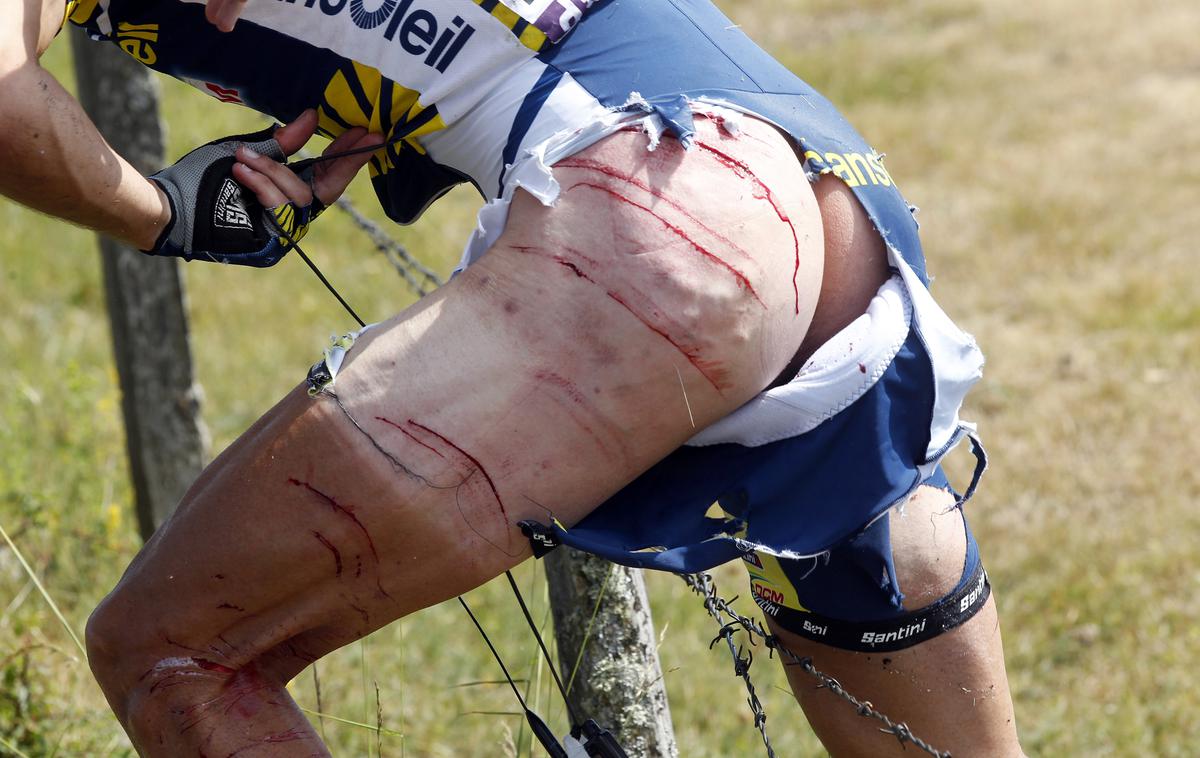 Johnny Hoogerland | Na žičnati ograji se je Johnny Hoogerland grdo porezal po nogah, zakrpali so ga s 33 šivi. A je z dirko nadaljeval. | Foto Reuters