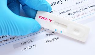 Cene testiranja na koronavirus se bodo ohranile do 30. junija