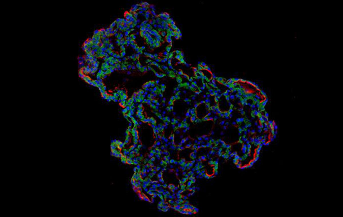 Pljuča Covid | Očem prijazna uprizoritev sicer mikroskopskega tridimenzionalnega organskega modela človeških pljuč, ki so jih v petrijevki vzgojili znanstveniki. | Foto Jeonghwan Youk, Taewoo Kim, Seon Pyo Hong