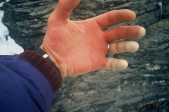 Davo Karničar je že leta 1996 načrtoval smučarski spust z Everesta (Klemenc ga je spremljal v vlogi snemalca), a so ga ozebline in vihar, v katerem je umrlo osem alpinistov, prisilile k sestopu. Podvig je izpeljal štiri leta pozneje. | Foto: 
