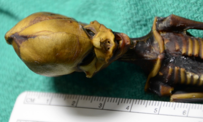 Miniaturno trupelce v dolžino meri le okoli 15 centimetrov, ima nenavadno podolgovato glavo s številnimi nečloveškimi lastnostmi, manjka pa mu tudi par reber.  | Foto: Emery Smith