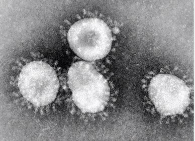 Virus sars-cov-2, osebni arhiv T. Lejko Zupanc | Foto: osebni arhiv/Lana Kokl