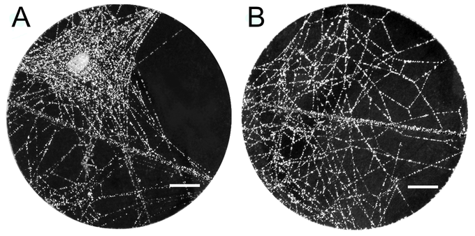 Desno (B) "klasična" pajkova mreža, levo (A) pa pajkova mreža po tem, ko je ličinka parazitske ose prevzela nadzor nad pajkovim telesom. Dobro se opazi, da je mreža v bližini ličinke veliko gostejša in s tem primernejša za čim hitrejšo izdelavo kokona.  | Foto: plos.org