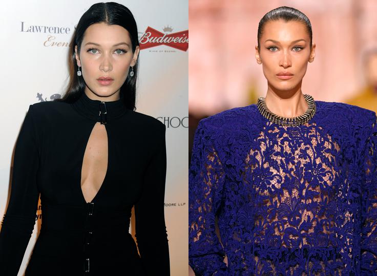 Manekenka Bella Hadid je znan primer, kako si je s posegi spremenila videz. | Foto: Guliverimage