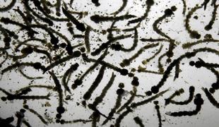 Znanstveniki odkrili povezavo med virusom zika in mielitisom